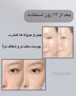 🌺۶ پپتاید کوزارکس🌺 - Image 2