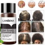 🎁 سرم تقویت کننده مو:لانبنا🎁 - Image 2