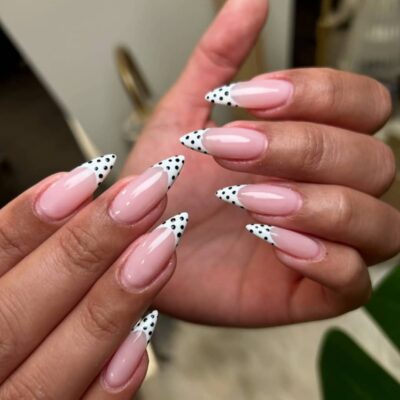 کاشت اولیه ژل